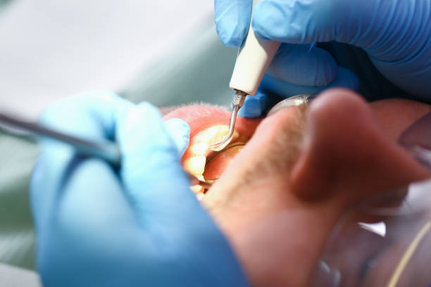Best Emergency Dental Care for Sports Injuries in Sunnyslope, WA