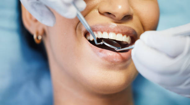 Best Dental Abscess Treatment in Sunnyslope, WA
