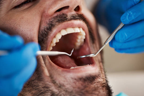 Best Emergency Cosmetic Dentistry (e.g., broken veneers) in Sunnyslope, WA